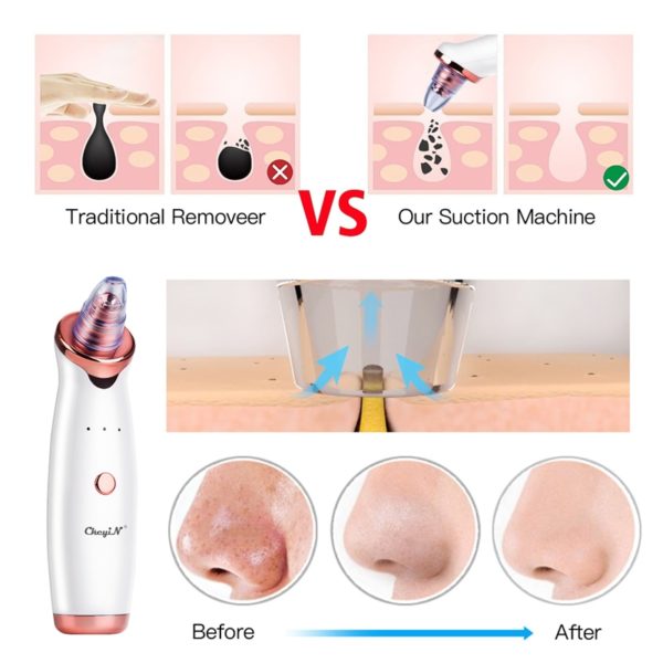 Electric Blackhead Remover Vacuum Suction Black Head Removal Facial Acne Pore Cleaner Extractor Tool Diamond Care 5 Probes 38